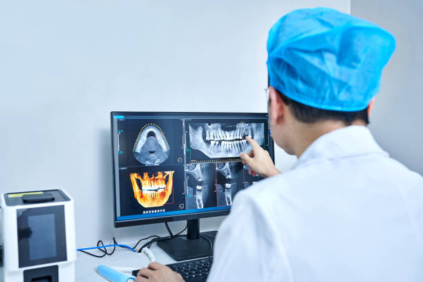 Best Emergency Wisdom Teeth Removal in Bellbrook, OH